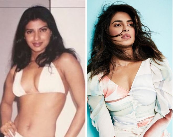 Priyanka Chopra admits that nose surgery has completely changed her face PHOTO: INSTAGRAM NV